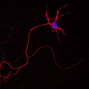 Schéma ou photo montrant la grande longueur des neurites