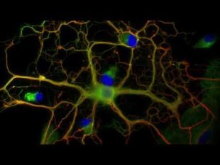 Vidéo « Pot de colle ! Neurones et cellules gliales »