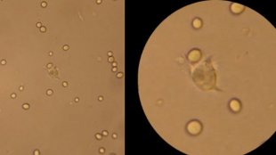 Vidéo phagocytose levures par des hémocytes d’huître