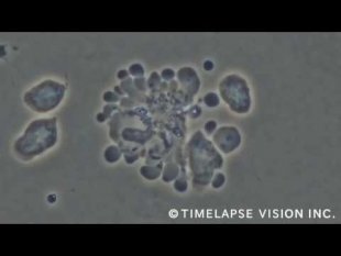 Lymphocyte T cytotoxique détruisant une cellule cancéreuse (2)